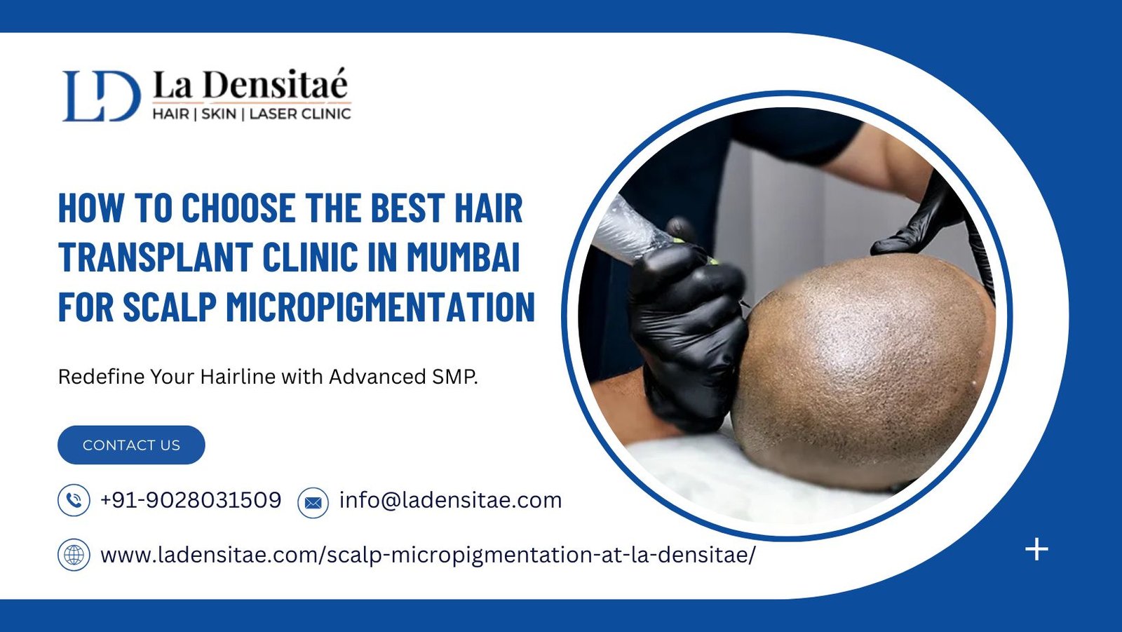How to Choose the Best Hair Transplant Clinic in Mumbai for Scalp Micropigmentation