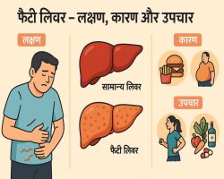 फैटी लिवर - लक्षण, कारण और उपचार | फैटी लिवर रोग की सम्पूर्ण जानकारी