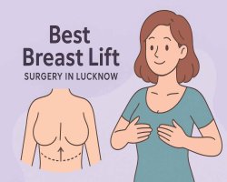 Best Breast Lift Surgery in Lucknow: Top Surgeons, Clinics & Non-Surgical Options