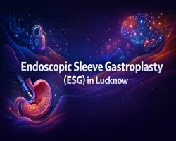 Endoscopic Sleeve Gastroplasty (ESG) in Lucknow: Non-Surgical Weight Loss